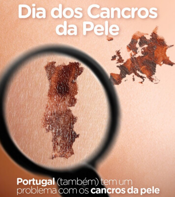dia-dos-cancros-de-pele-image